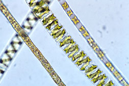 Spirogyra