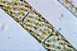 Spirogyra