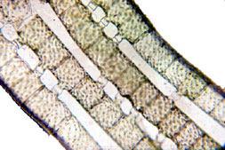 Spirogyra