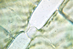 Spirogyra