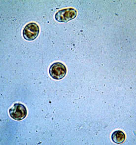 Nori zygotospores