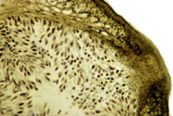Fucus female conceptacle